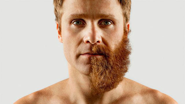 How to Grow a Beard Fast: The Only Guide you will Need